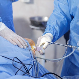 Could Arthroscopic Surgery in Clear Lake, Kingwood and Lake Jackson Be the Solution to You...